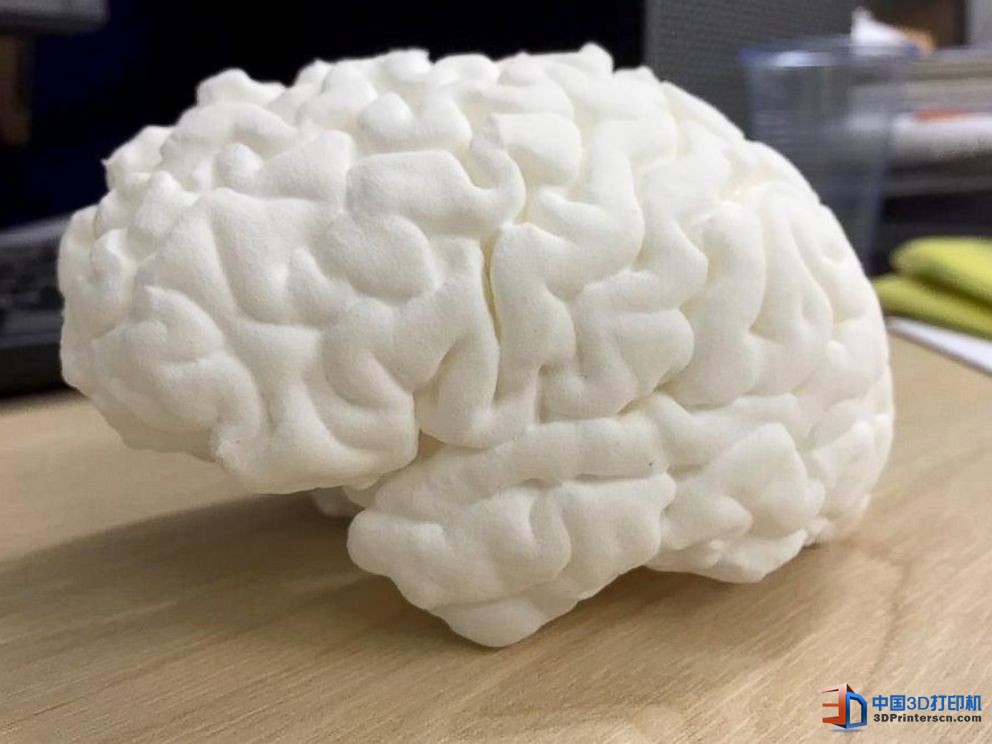 未來醫(yī)療行業(yè) 3D打印技術(shù)融入其中的四種方式
3D醫(yī)療行業(yè),3D打印心臟,3D打印大腦,3D打印應(yīng)用,3D打印領(lǐng)域,3D打印和醫(yī)療的關(guān)系,3D打印平臺,3D打印服務(wù),3d打印企業(yè)服務(wù)平臺