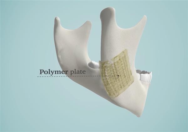解決醫(yī)生煩惱 3D打印生物陶瓷修復(fù)骨骼


生物陶瓷,3D打印生物陶瓷,工業(yè)3d打印機,3D打印機價格,3D打印服務(wù),3D打印技術(shù),中國3d打印技術(shù),上海3D打印,北京3D打印
