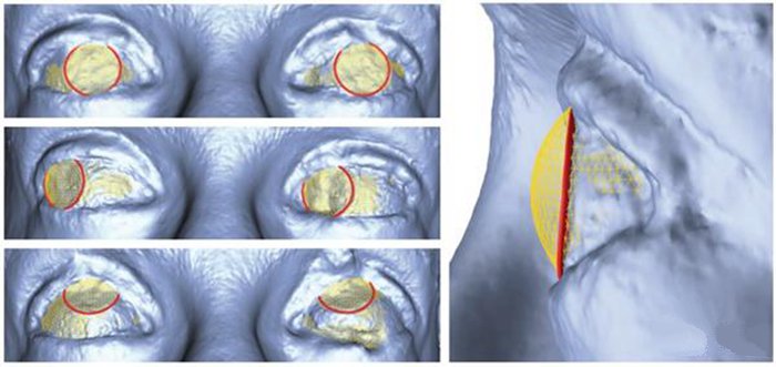 3D打印新技術 迪斯尼用照片重建繪制3D眼部立體圖_e鍵3D打印服務 3D打印新技術 迪斯尼用照片重建繪制3D眼部立體圖_e鍵3D打印服務