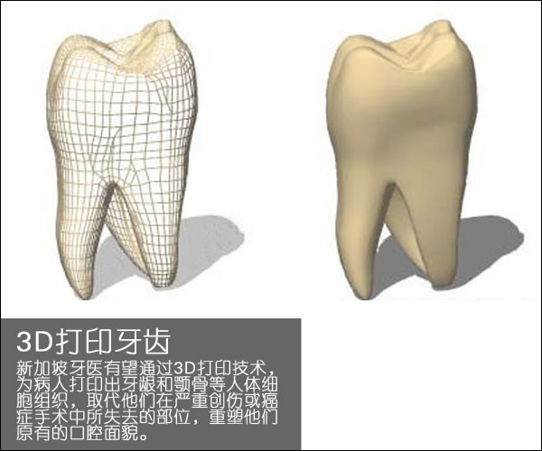 個性化醫療3D打印實戰案例與研究成果的問答整理_3d打印服務公司