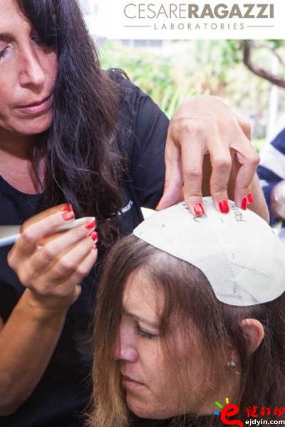 另類治療脫發的最好方法 用3D打印超逼真假發解決困擾 治療脫發不再煩,3d打印頭發,假發3d模型,3d打印材料,3d打印服務,3d打印廠家 另類治療脫發的最好方法 用3D打印超逼真假發解決困擾 治療脫發不再煩,3d打印頭發,假發3d模型,3d打印材料,3d打印服務,3d打印廠家