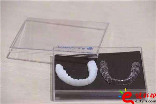 3D打印牙嵌體和牙套哪種更好?3D打印牙齒/隱形牙套/牙冠/模型/成品價格表 3D打印牙嵌體和牙套哪種更好?3D打印牙齒/隱形牙套/牙冠/模型/成品價格表