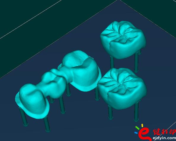 3d打印牙齒價格,3d打印牙齒模型,3d打印牙齒臨床了嗎,3d打印牙齒價格表,3d打印牙齒能用多久