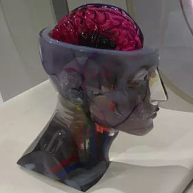 彩色3d打印人體器官醫學模型4